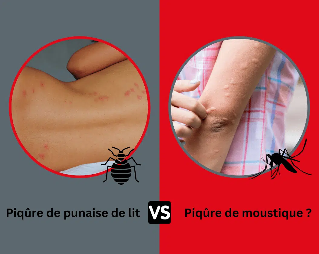 Soulager et prévenir les piqûres de moustiques - Conseils santé
